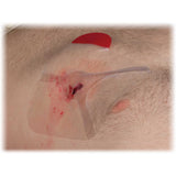 HYFIN VENT COMPACT CHEST SEAL TWIN PACK